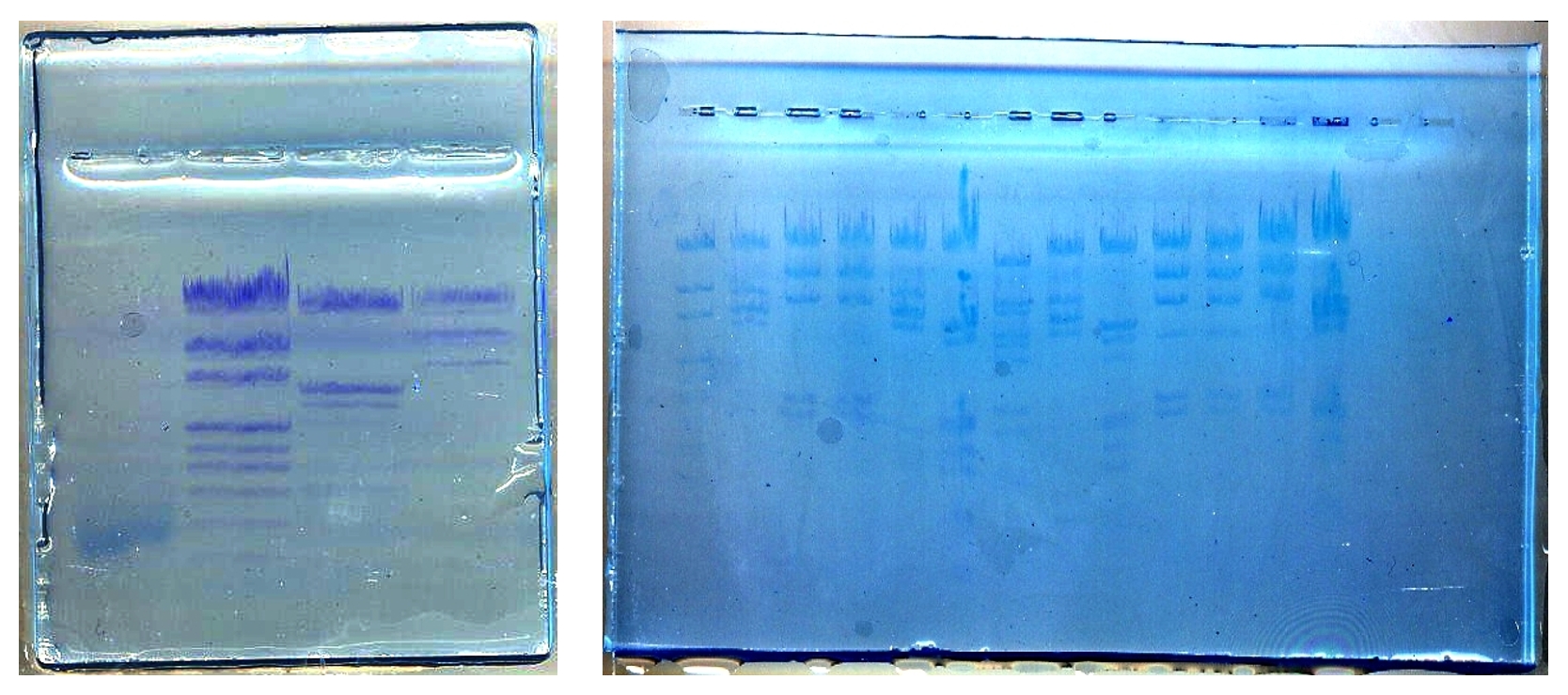 Électrophorèse d’ADN sur gel d’agarose — free download